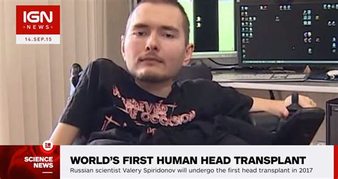 human head transplant results|The first human head transplant: 'it will be a success'.